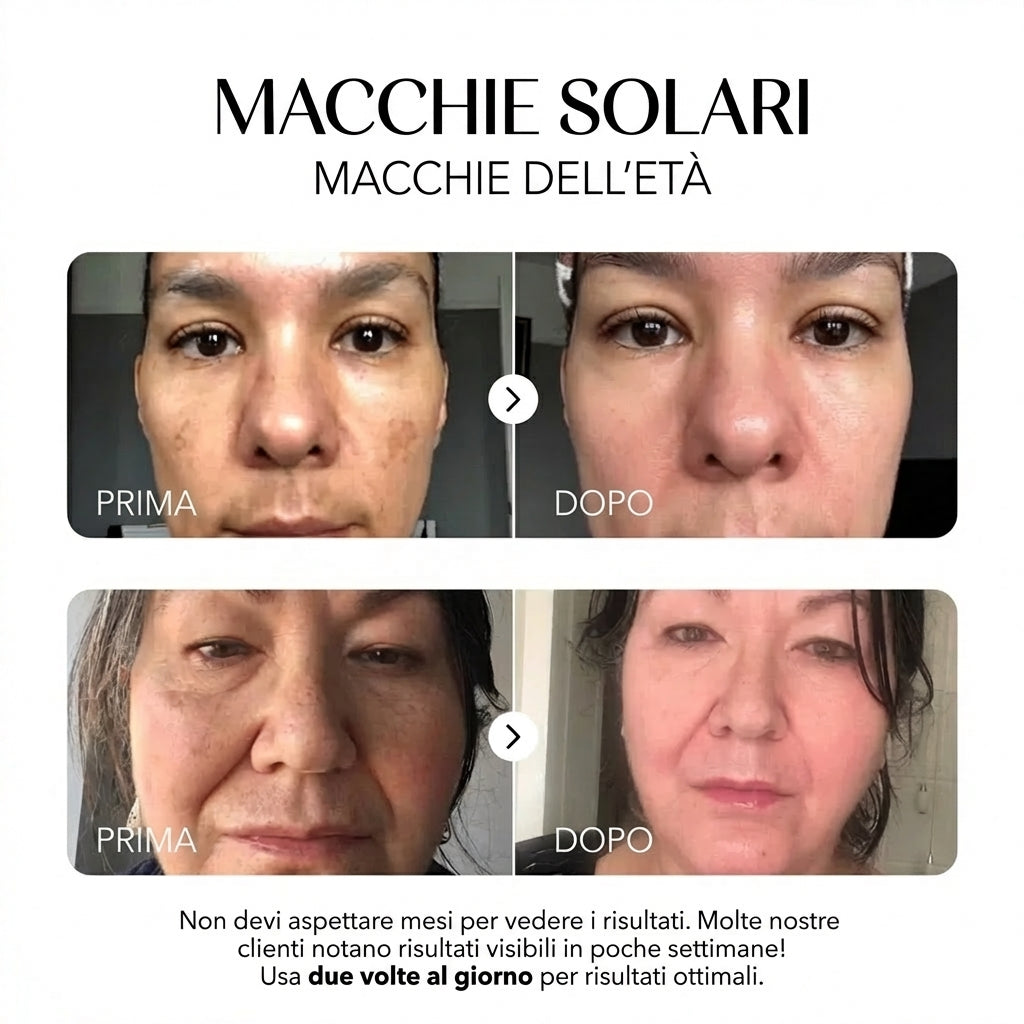 Rosyra Siero Anti-Macchie